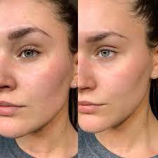 The Glow Facial